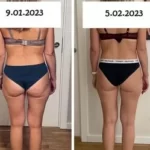 before-after-28dienas