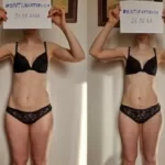 before-after
